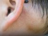 Is painless swollen lymph nodes behind the ear da.nge.rous?