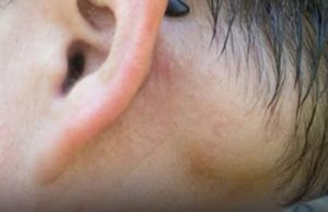 Is painless swollen lymph nodes behind the ear da.nge.rous?