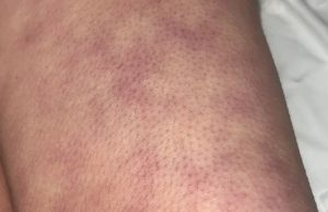 These are the consequences of sleeping with the…