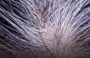 Can gray hair be reversed? Science answers